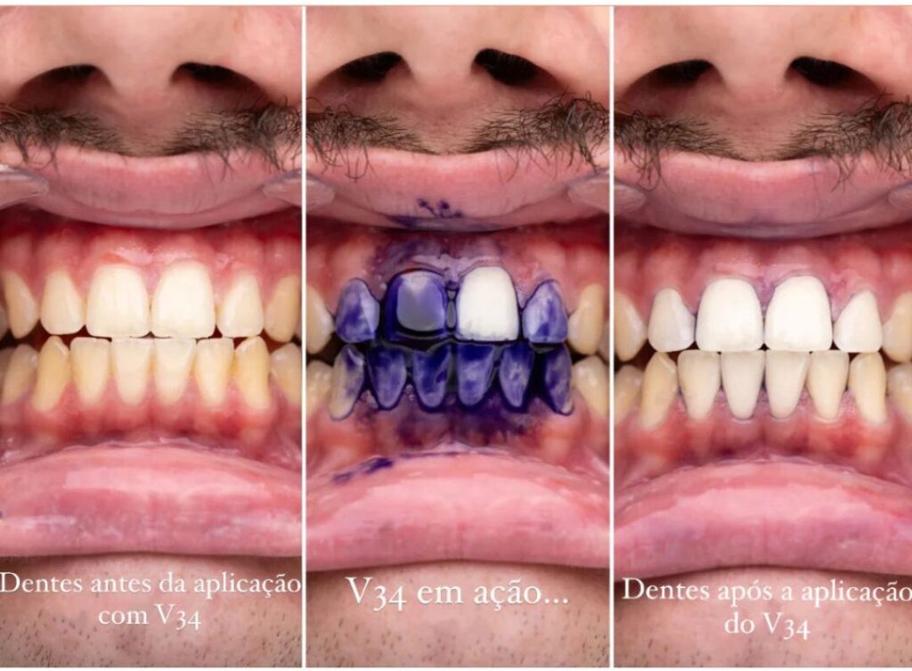 Serum V34 Where to Buy: Learn More