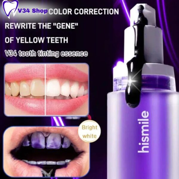 V34 Purple: Hismile V34 clareador dental