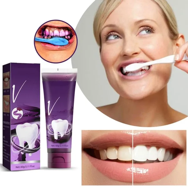 Novo creme dental clareador dental 5D