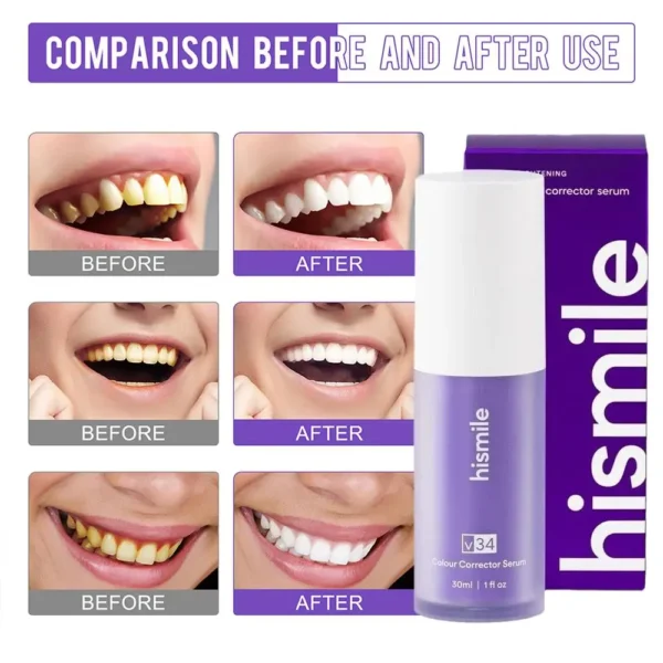 Hismile V34: Sérum clareador dental V34 30ml - Imagem 5