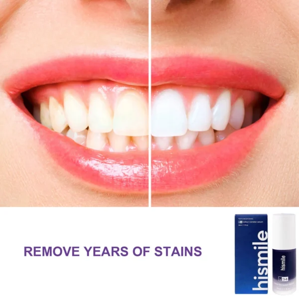 Hismile v34 colour corrector