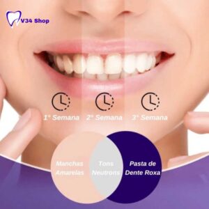 Tiras de clareamento de dentes roxo Oralhoe: Strips v34 Oralhoe